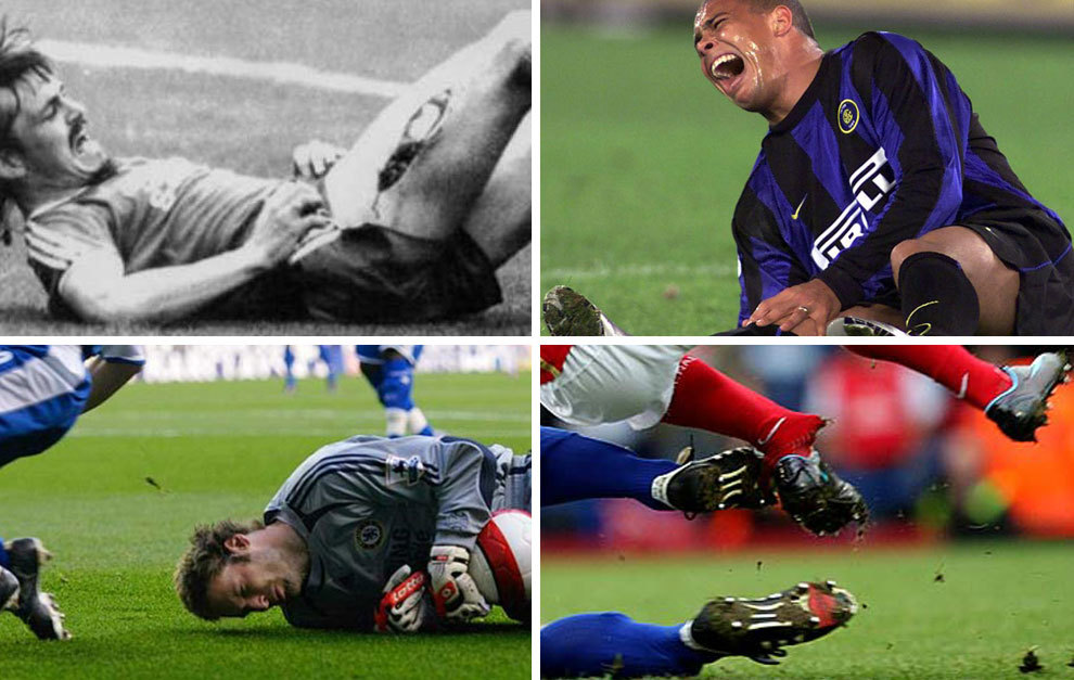 The most disturbing injuries in football history | MARCA English