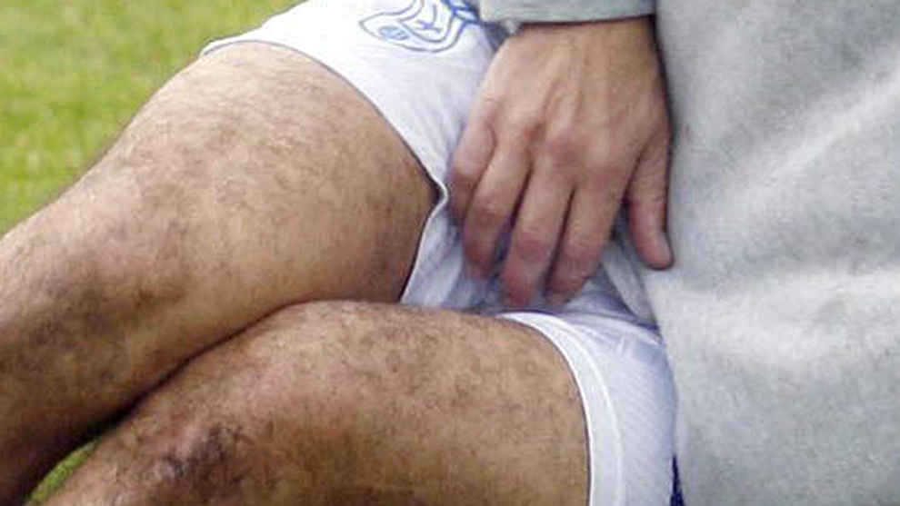 Un futbolista tras recibir un golpe en los test�culos