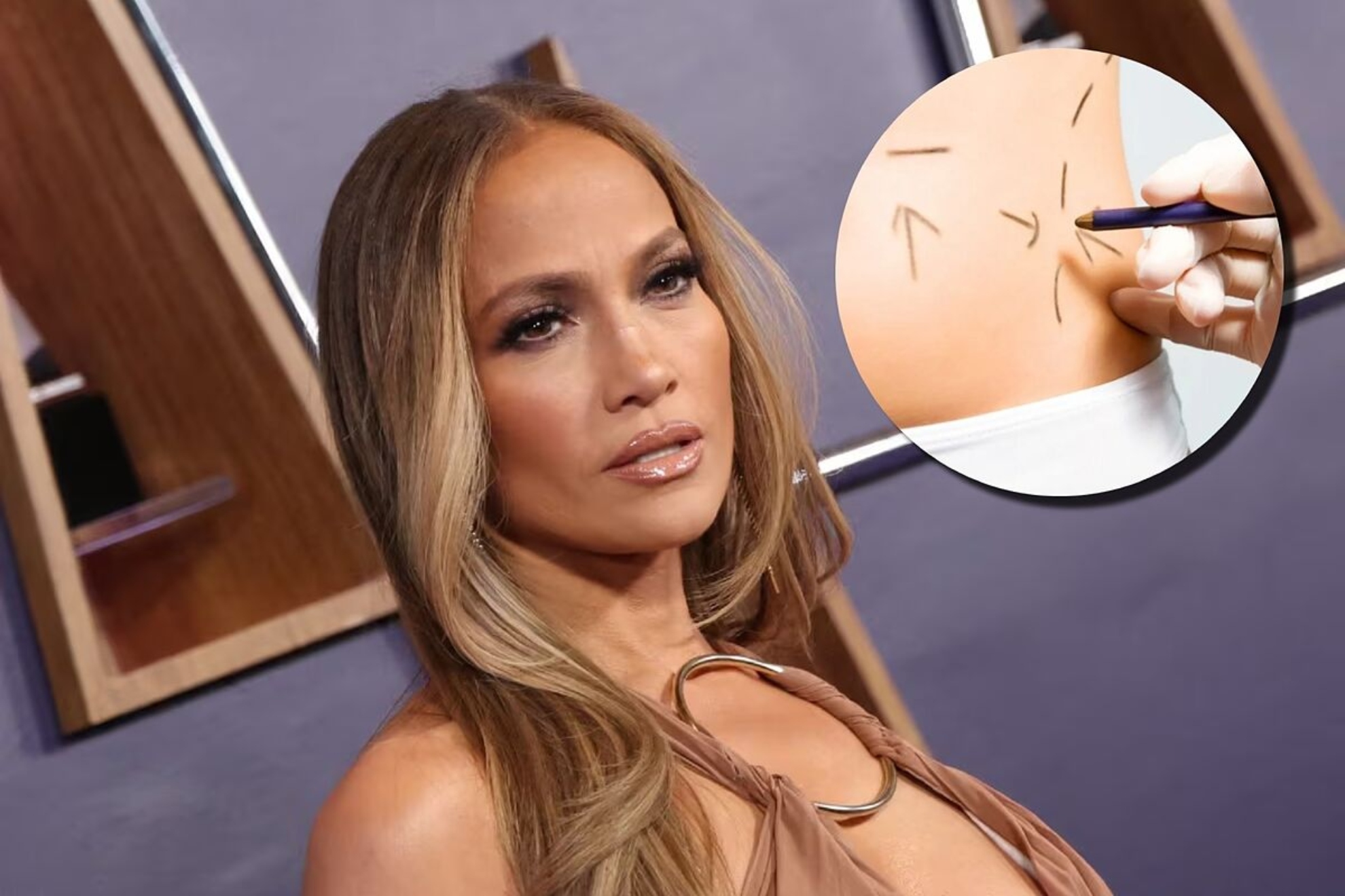 Jennifer Lopezs entourage is very concerned about her health after announcing more plastic surgery after breast augmentation