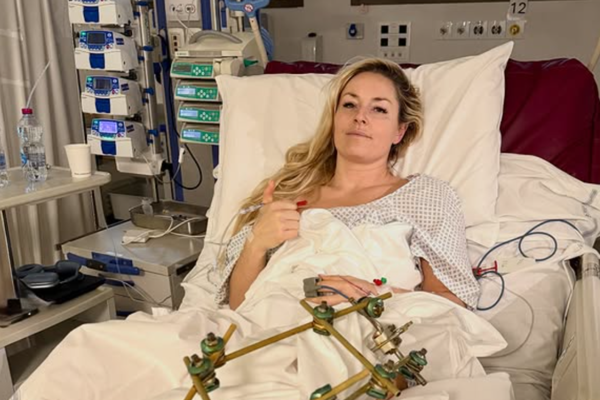 Lindsey Vonn shared an update on her condition after undergoing a third procedure on her broken leg