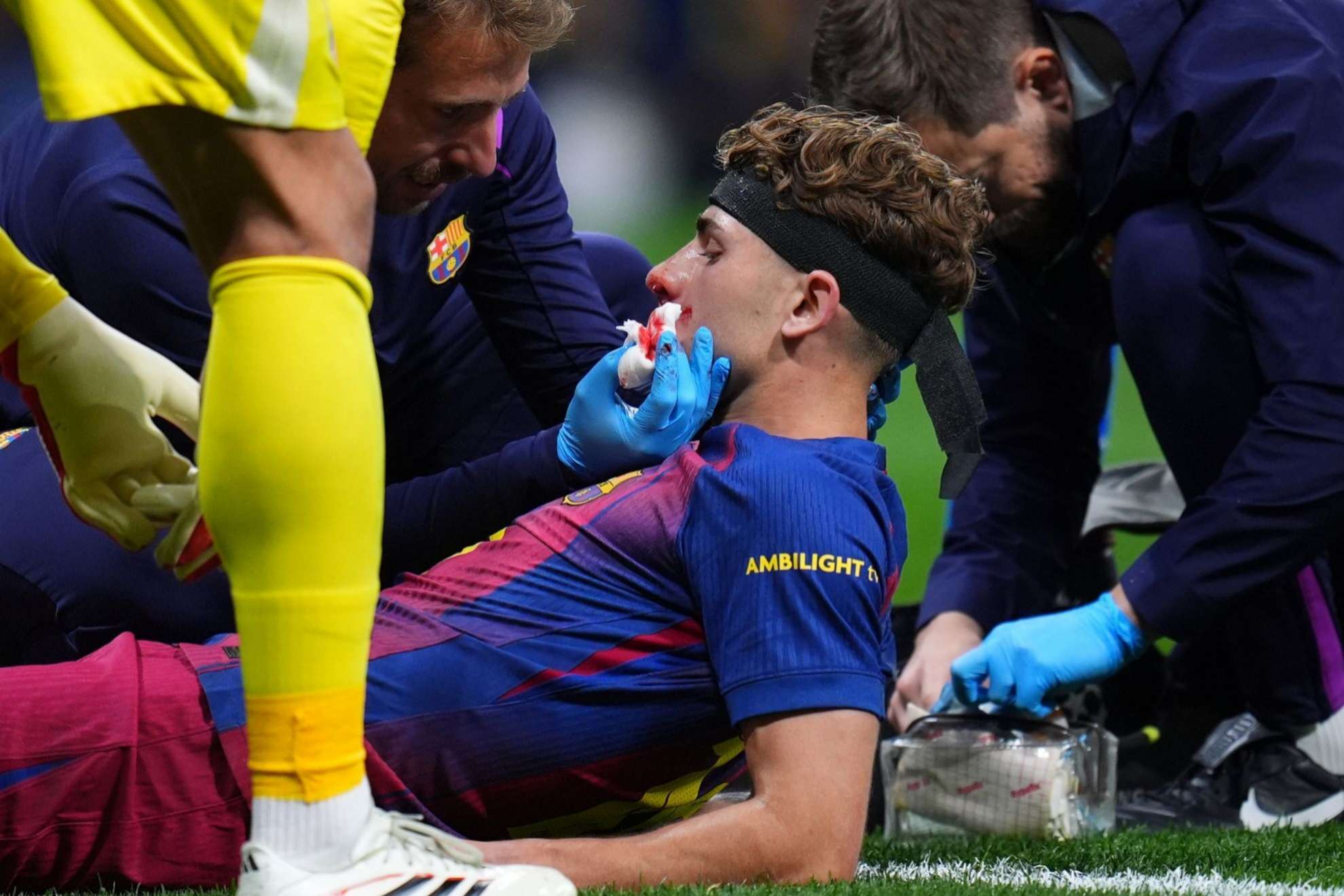Barcelona player suffers brutal blow and ends up bloodied in match against Atlético Madrid