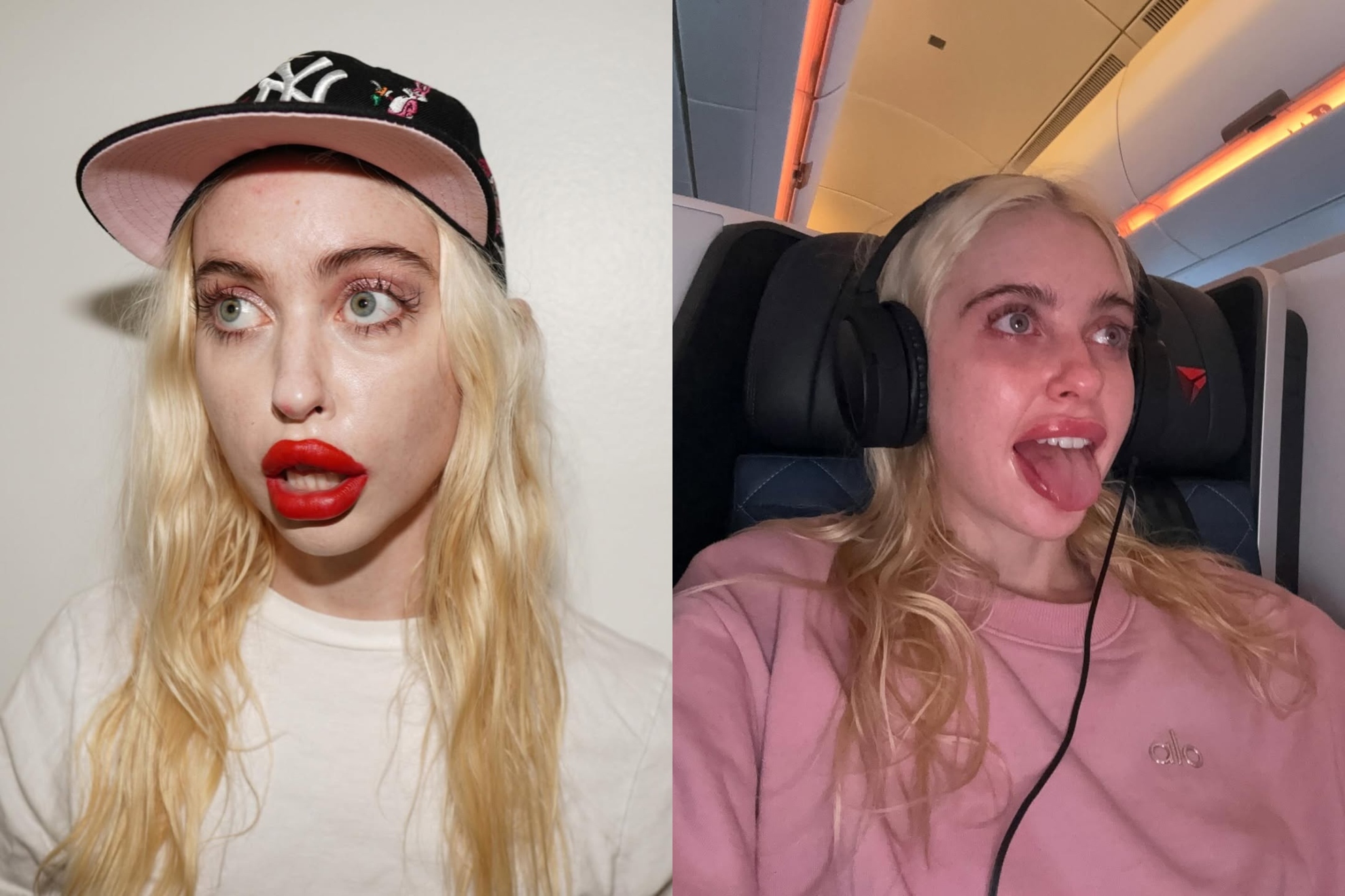 Chloe Cherry, intérprete conocida por aparecer en ‘Euphoria’, sobre sus labios: “Decidí ponerme bótox y rellenos porque no me gustaba el aspecto de mi cara”
