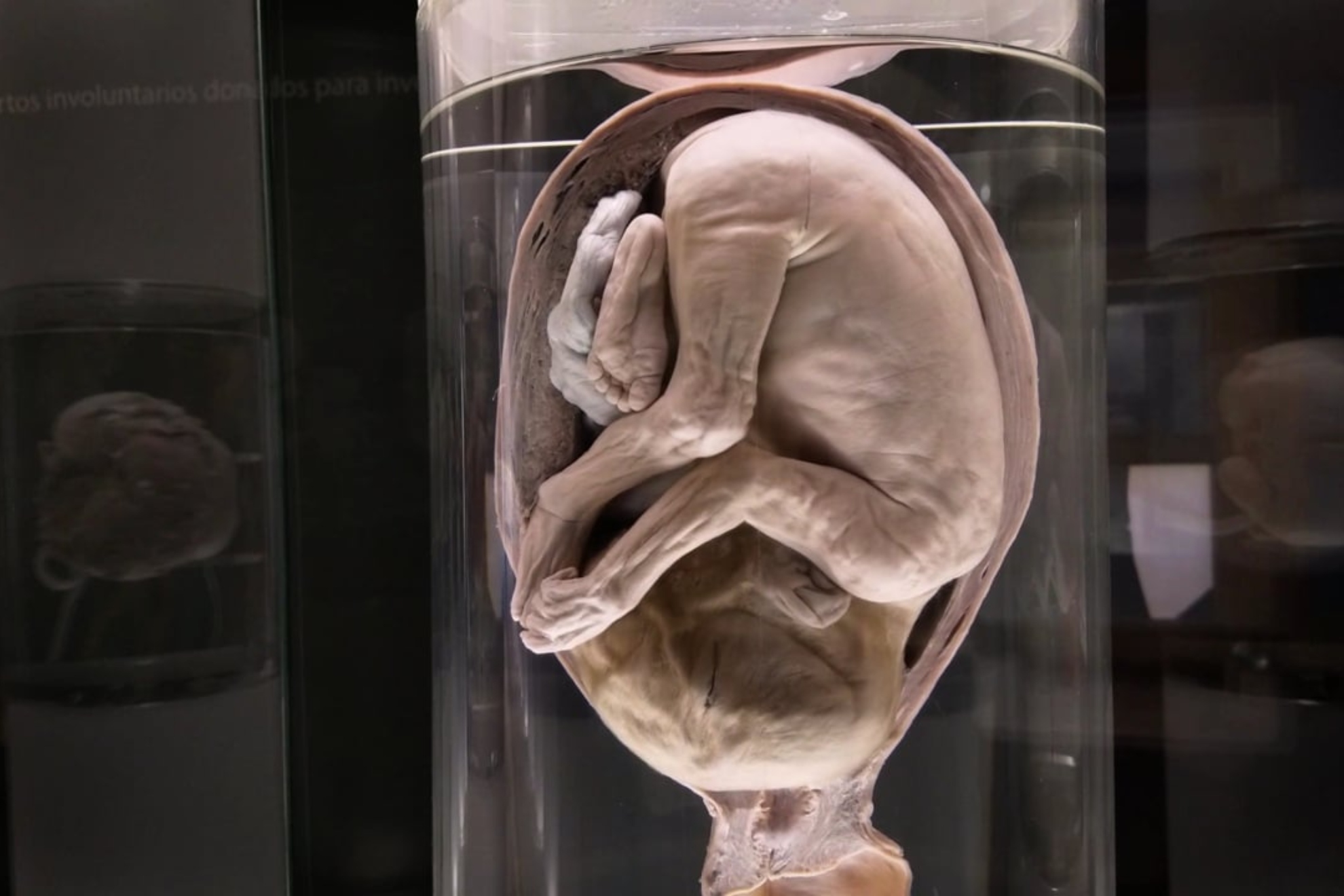 Revolución en el mundo animal: se encuentran los embriones de reptil más antiguos jamás documentados dentro de fósiles de más de 280 millones de años