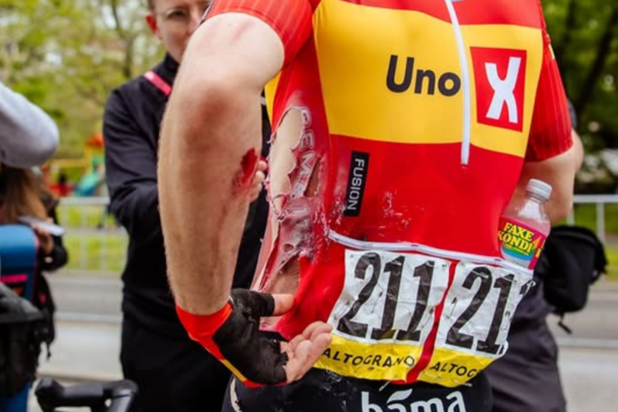El héroe dolorido que corrió diez etapas del Giro con cuatro fracturas: “Ahora el sufrimiento tiene sentido”