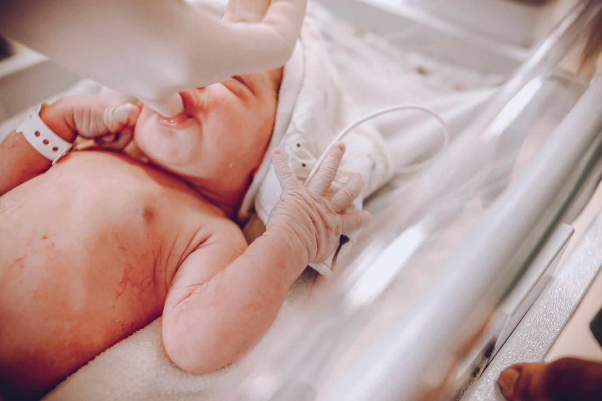 Una placenta artificial mantiene con vida durante 21 días a un feto prematuro en un ensayo pionero en Europa