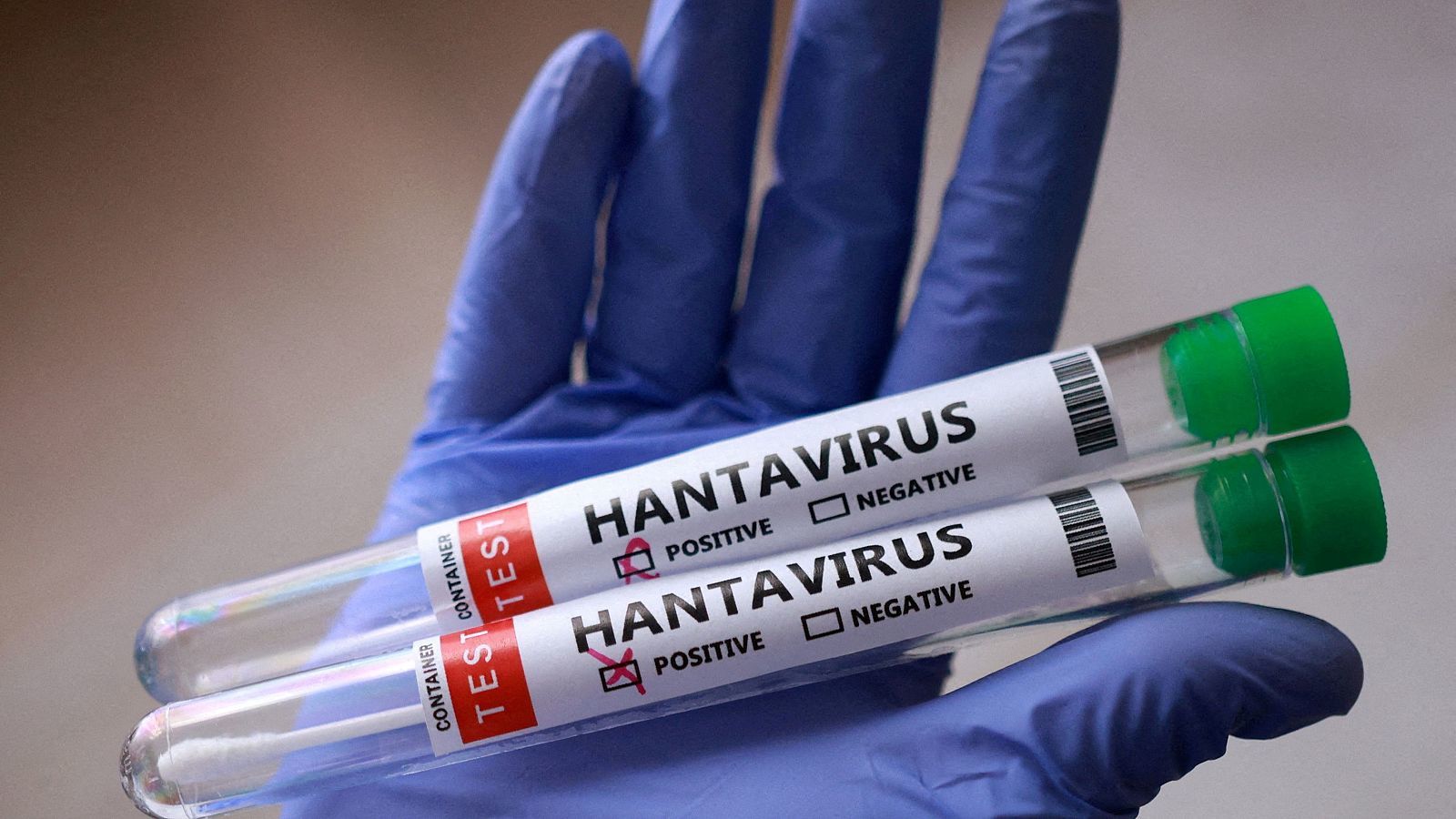 Aíslan en Galicia a un turista con hantavirus tras detectarse un positivo de la variante Andes en Francia