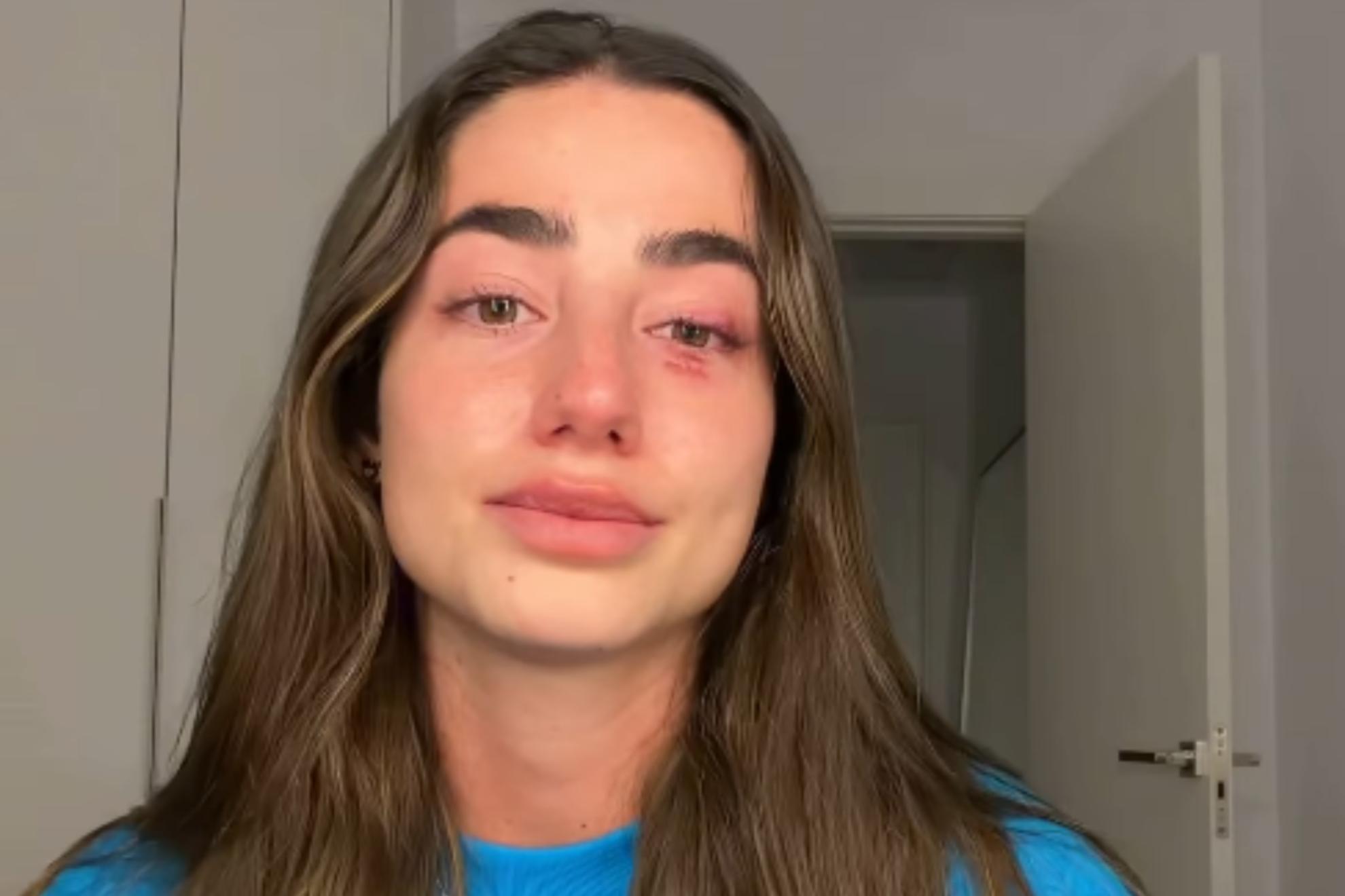 Lola Lolita anuncia entre lágrimas que deja temporalmente las redes sociales para cuidar su salud mental: "No puedo más"