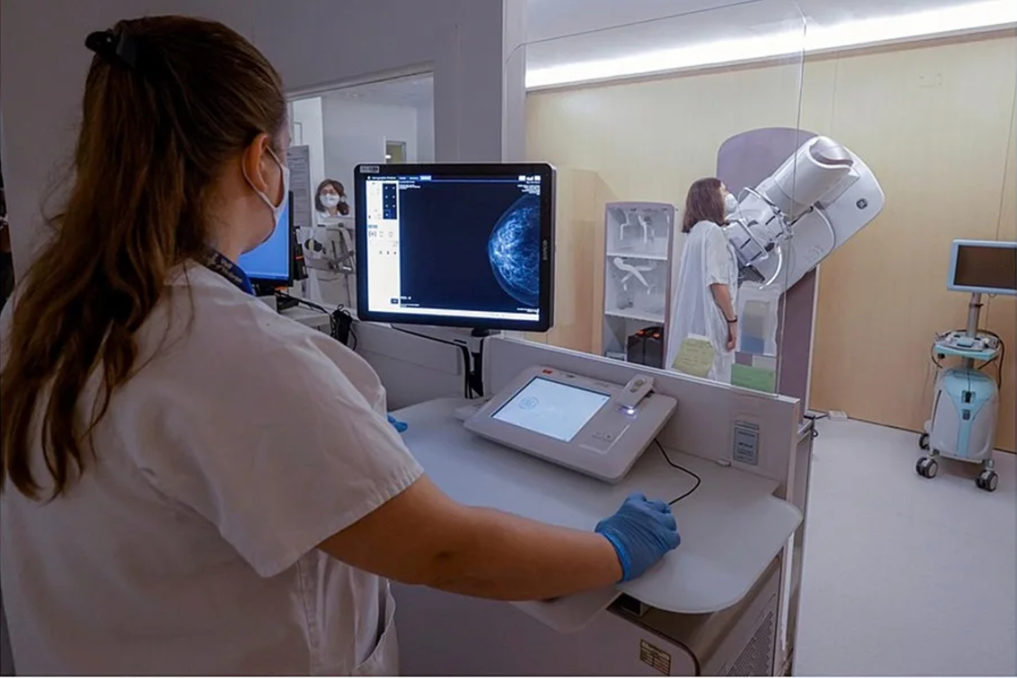 La inteligencia artificial puede predecir el riesgo de cáncer de mama durante cinco años con una sola mamografía