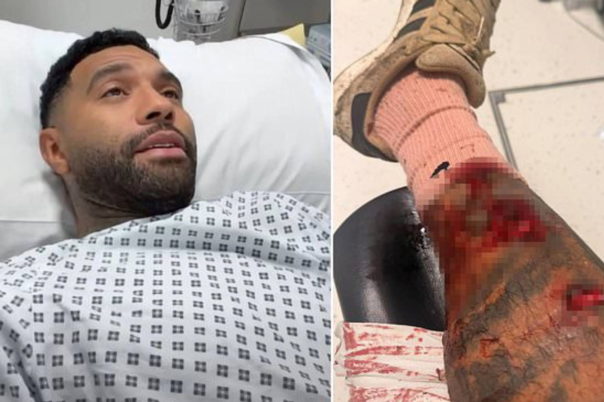 جيرمان بينانت ينجو من موت محقق ويحكي كواليس أزماته